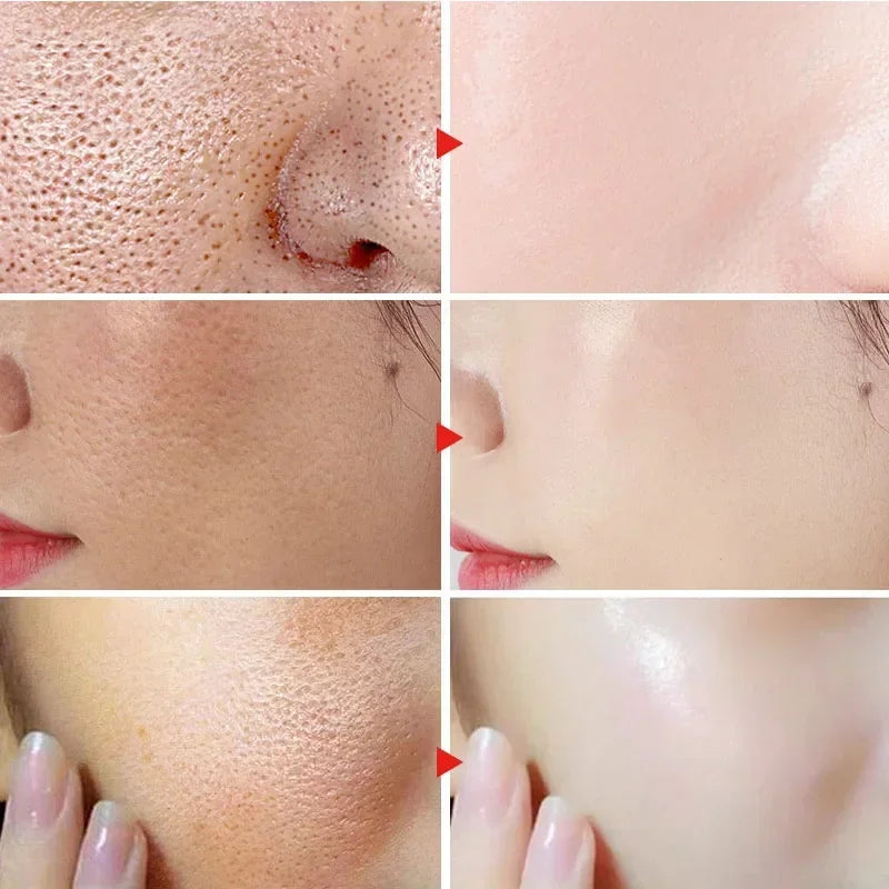 Lactobionic Acid Face Serum Pore Shrink Hyaluronic Acid Moisturizing Nourishing Firming Brighten Beauty Korean Cosmetics