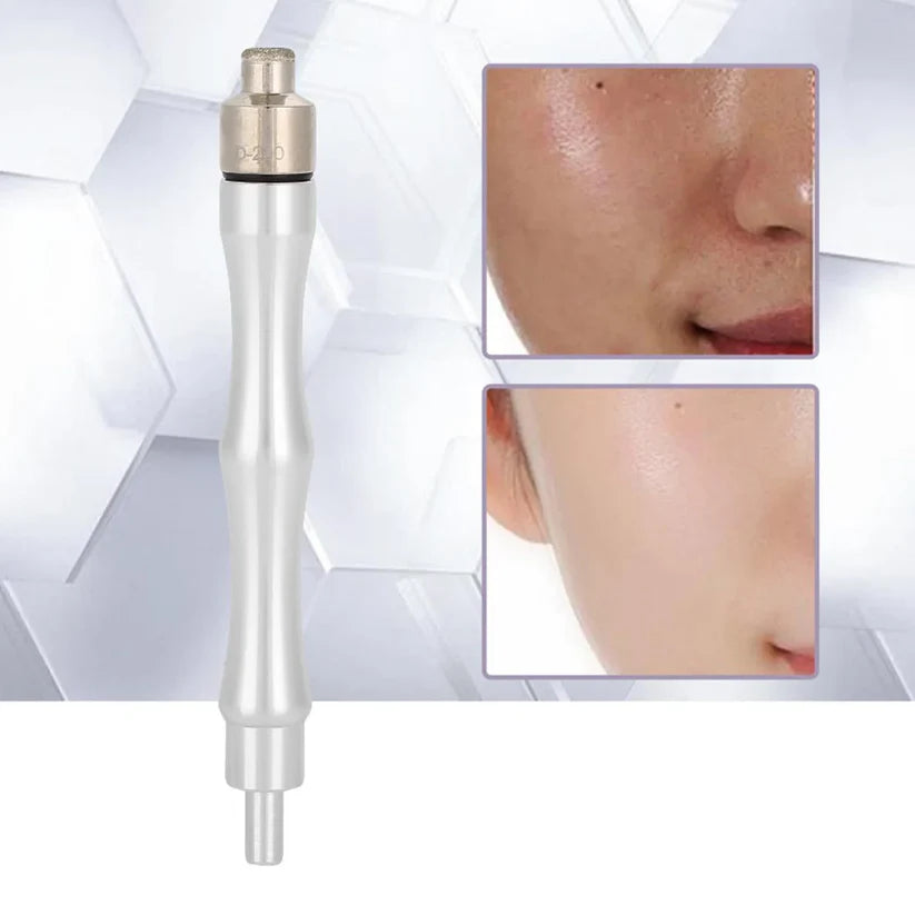 Beauty Machine Tips Tips Replacement Microdermabrasion Dermabrasion Tips with Handle Stainless Steel Filter Set