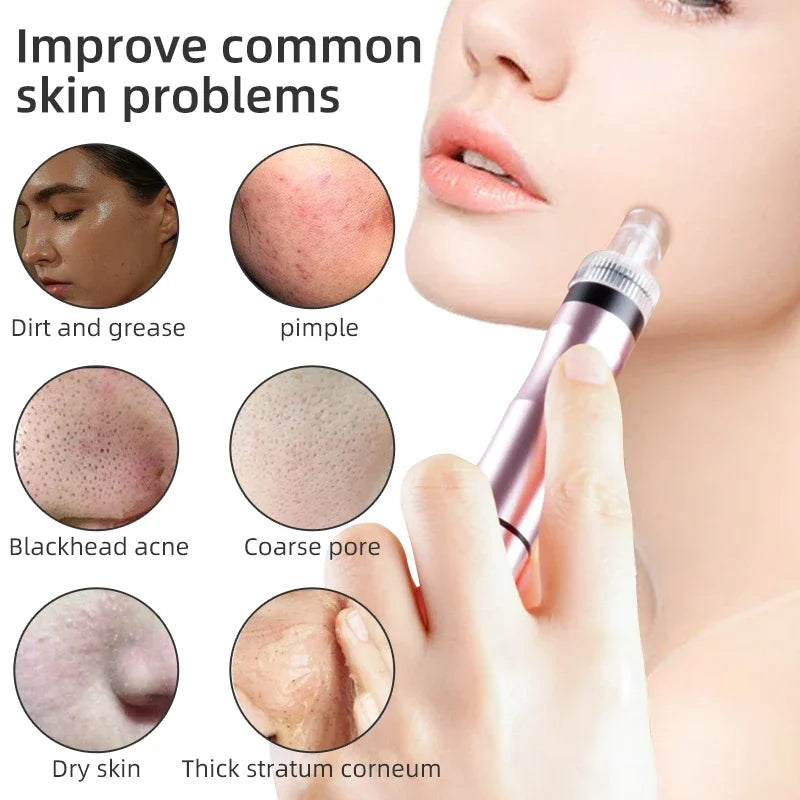 Bubble Facial Cleansing Machine Blackhead Removal Water Spray Hydro Jet Beauty Tool Face Pores Vacuum Suction Acne Cleaner